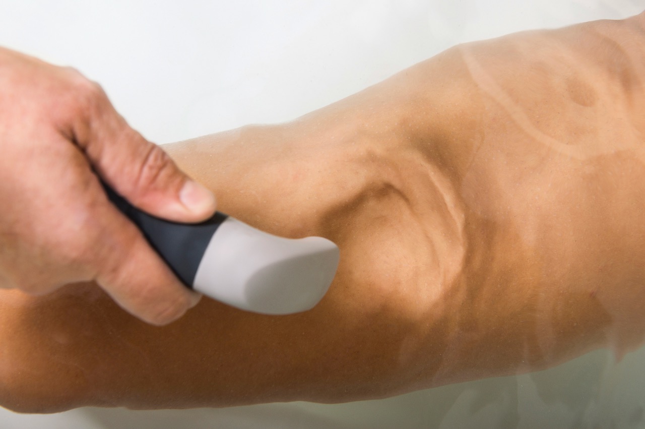 Underwater ultrasound